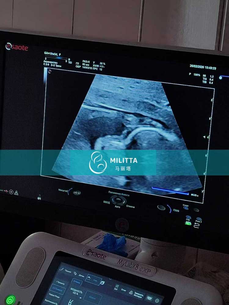 试管妈妈做B超