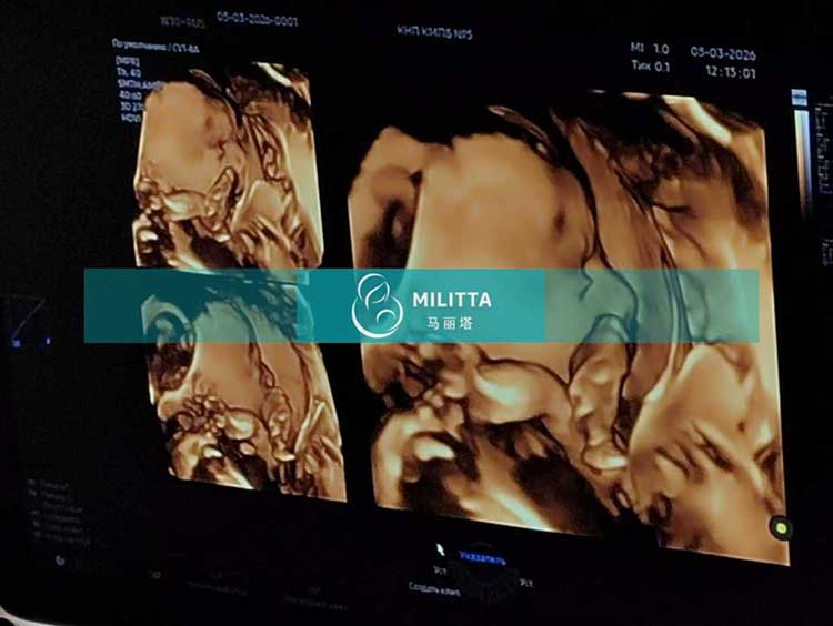 试管妈妈做产检