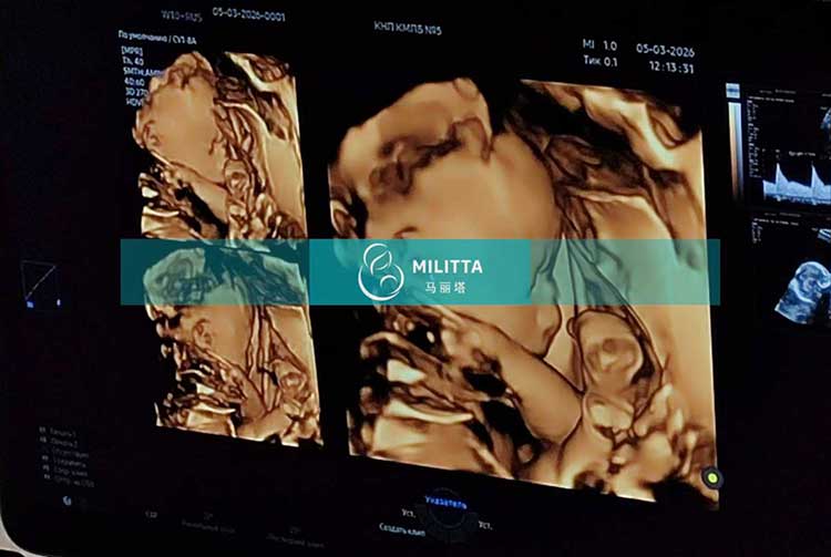 试管妈妈做产检