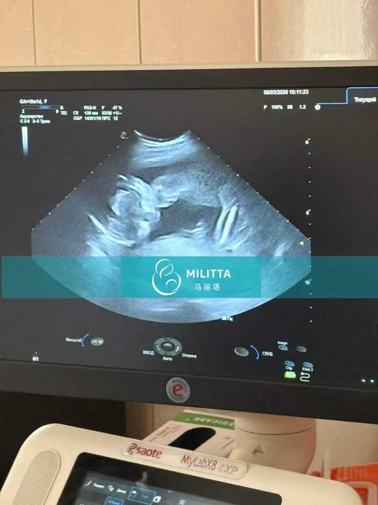 试管妈妈做产检