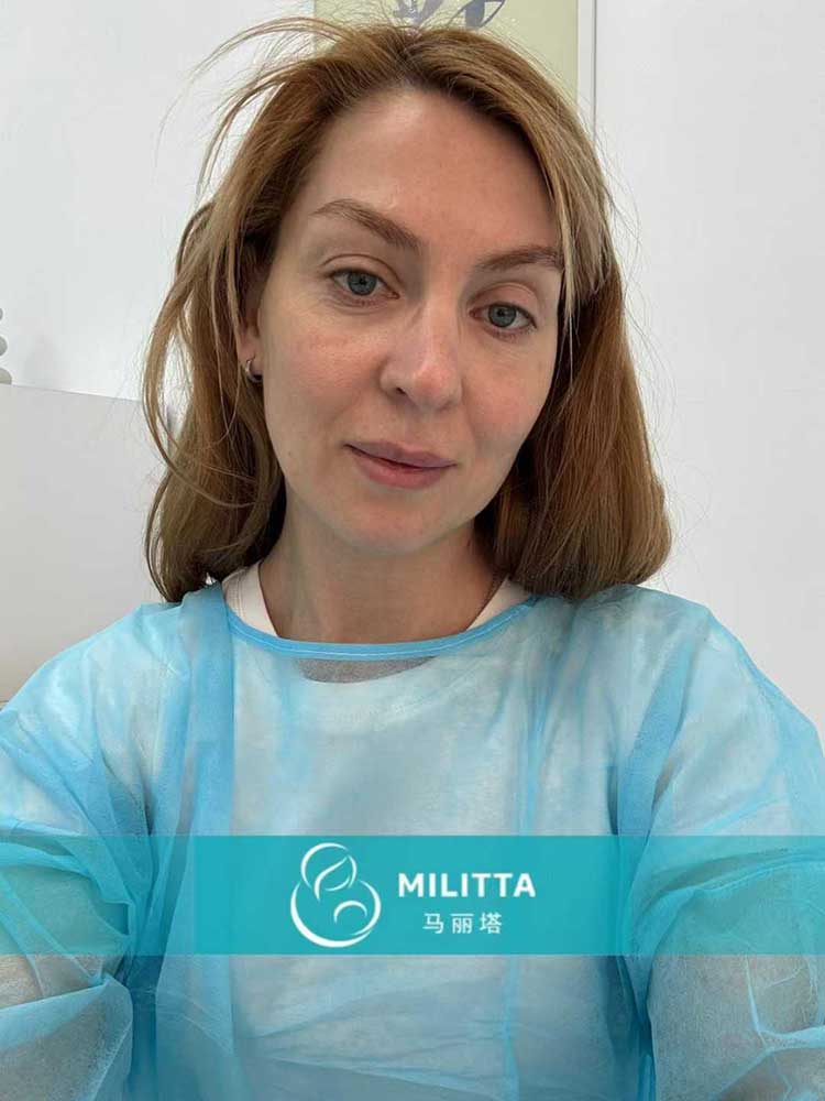 试管妈妈移植胚胎