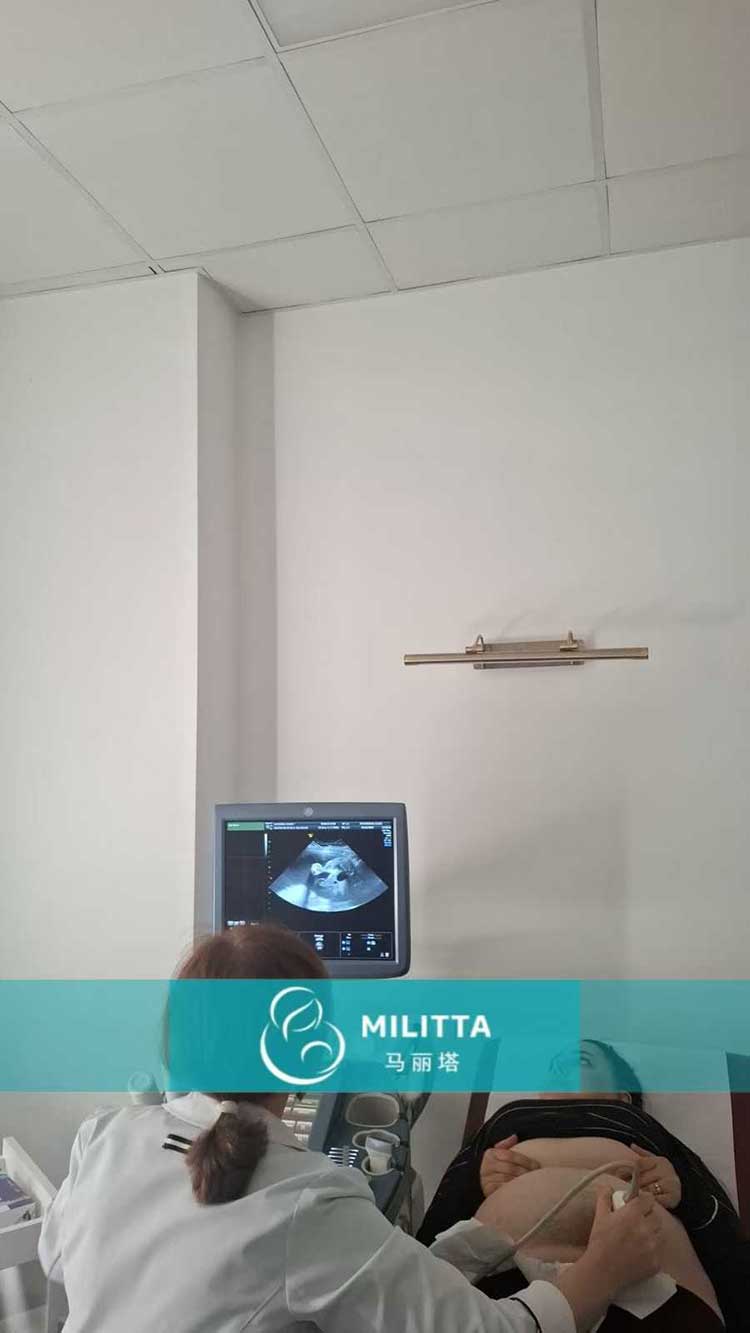 试管妈妈做产检