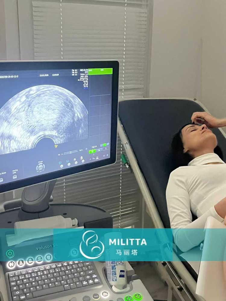 试管妈妈做产检