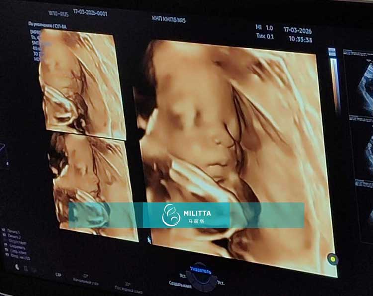 试管妈妈做产检