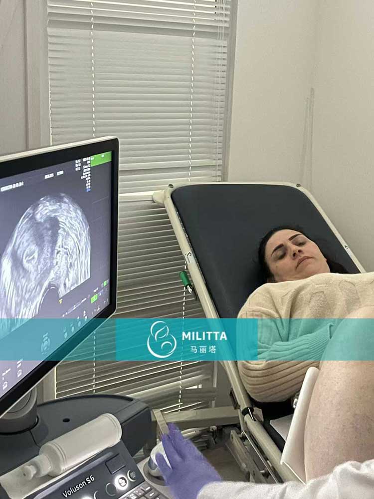 试管妈妈做移植前的检查