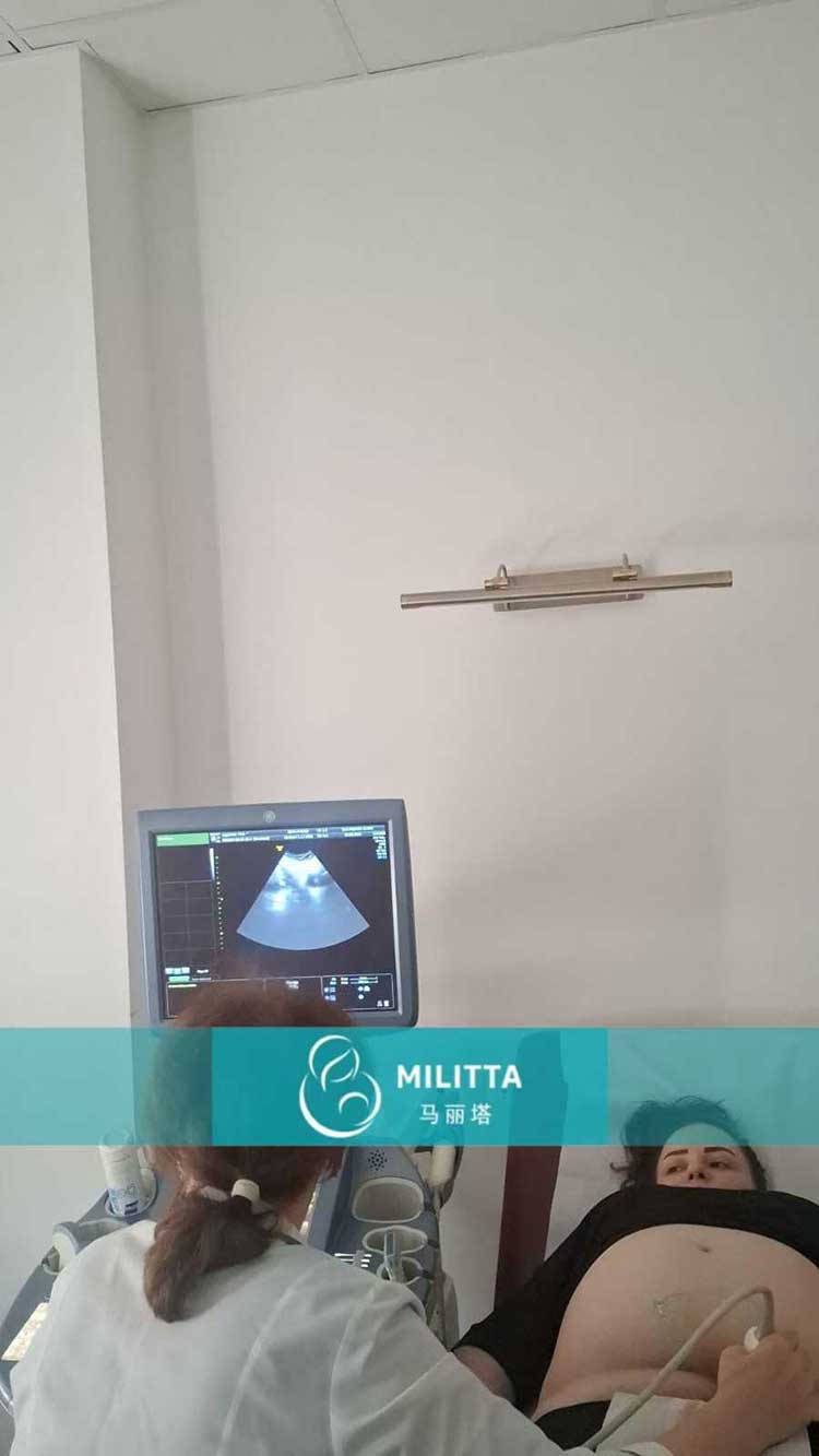 试管妈妈做产检