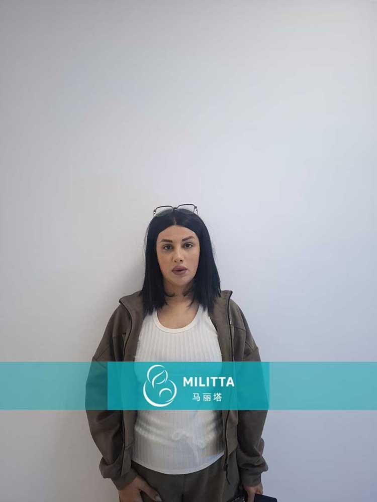 试管妈妈做产检