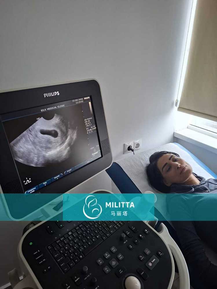 试管妈妈做检查