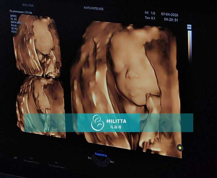 试管妈妈做产检