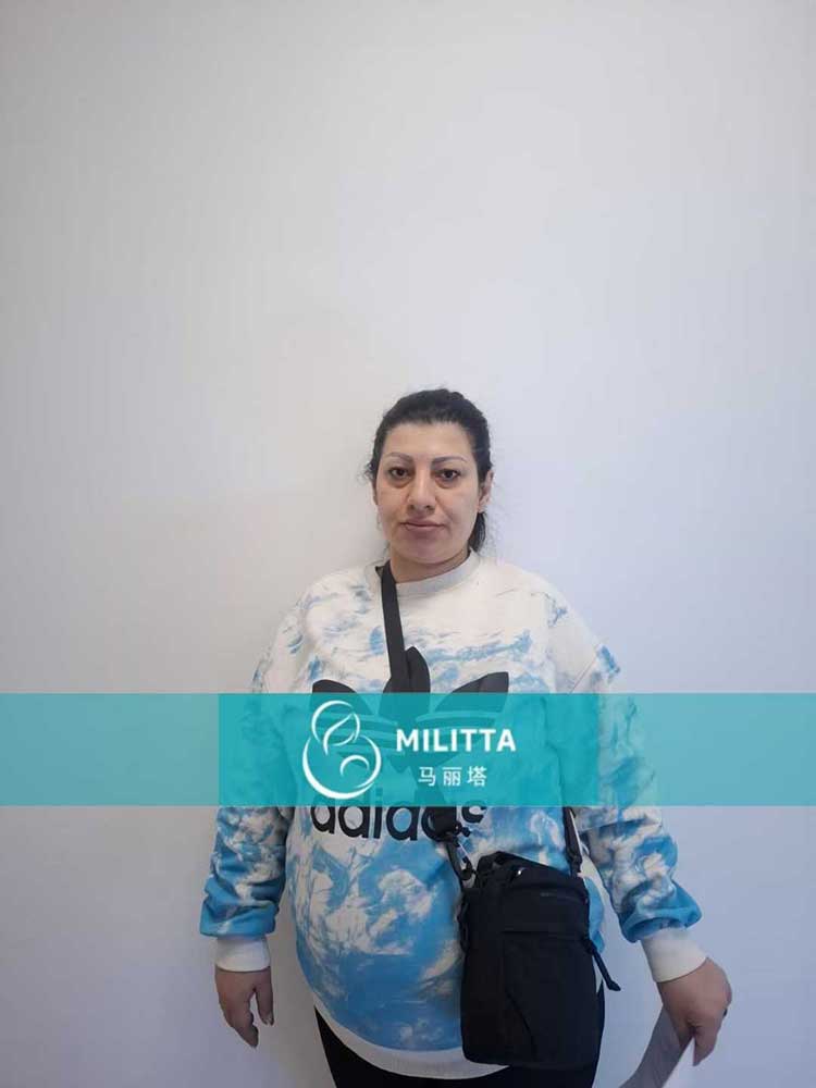 试管妈妈做产检