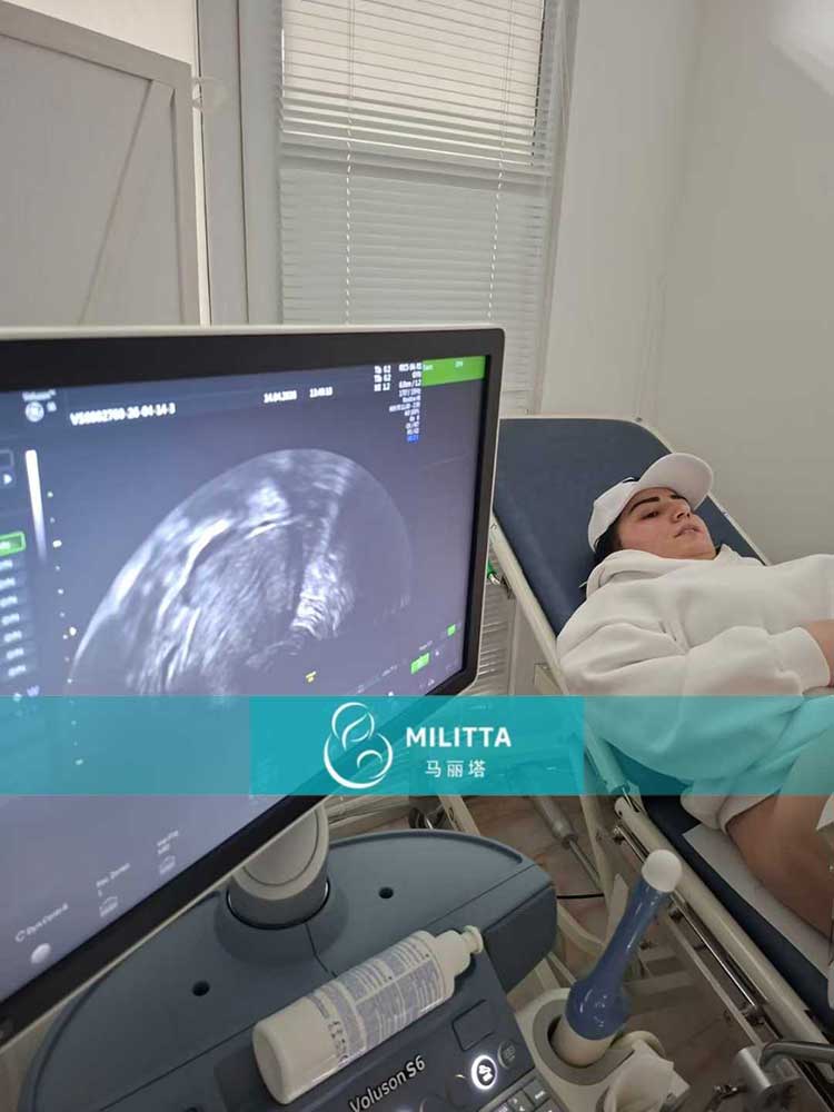 试管妈妈做产检