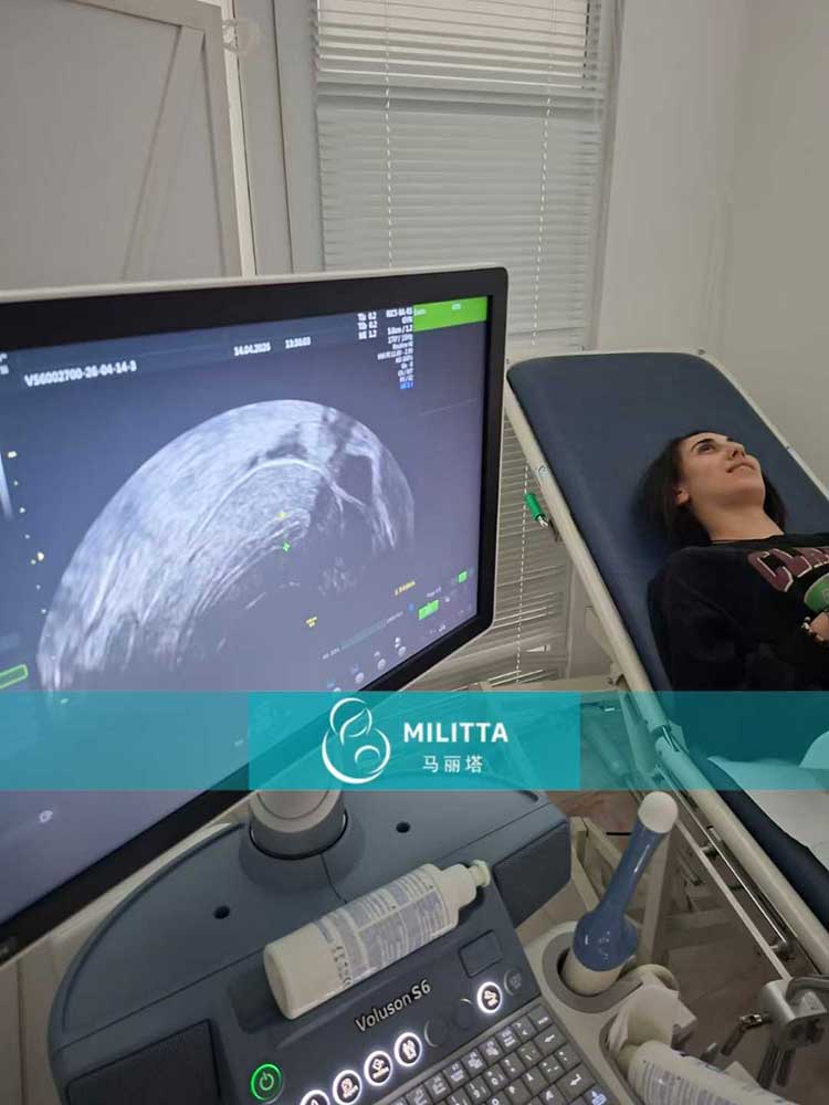 试管妈妈做产检