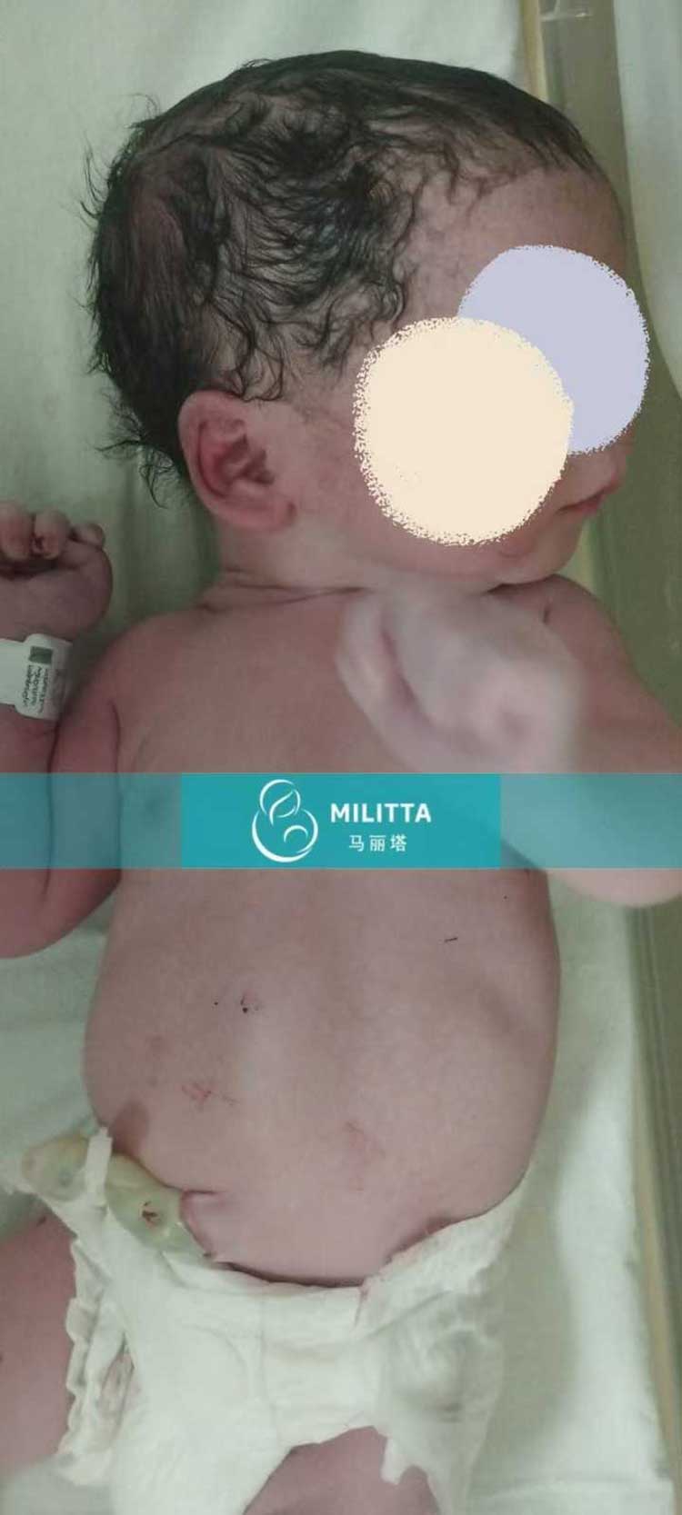 格鲁吉亚试管宝宝出生