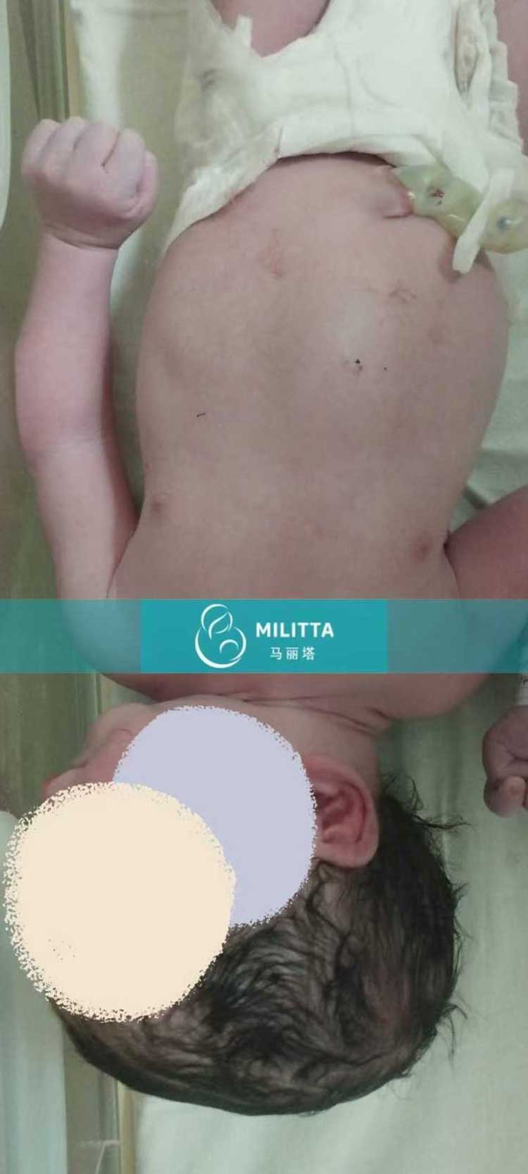 格鲁吉亚试管宝宝出生