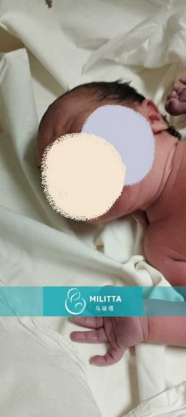 李夫妇在格鲁吉亚顺利迎来新生儿，产院拍出生