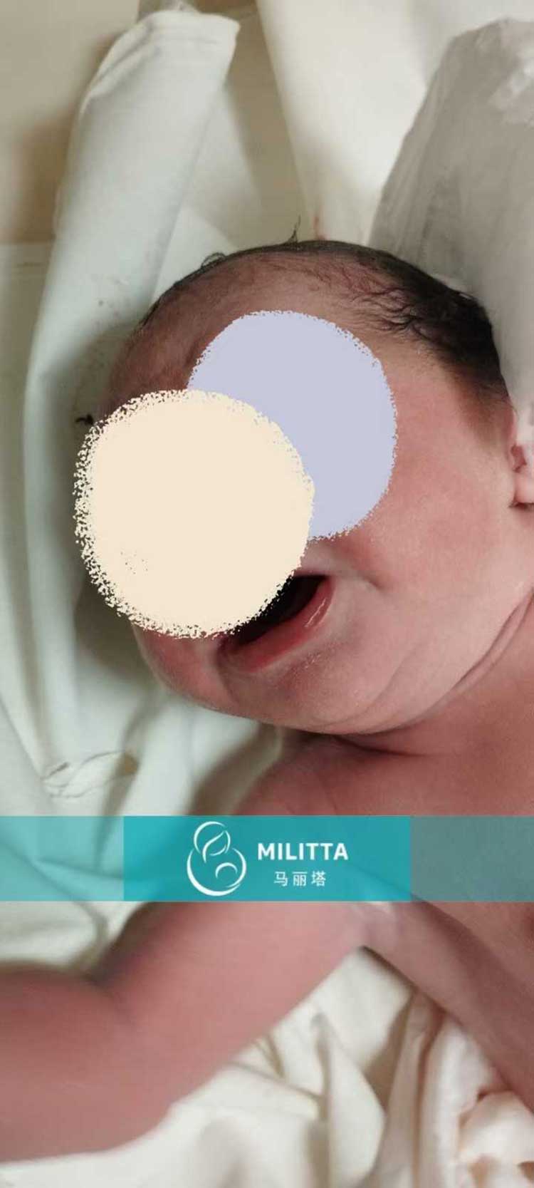 格鲁吉亚试管宝宝出生