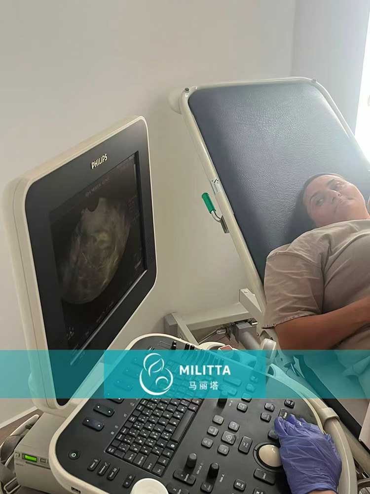 试管妈妈做产检