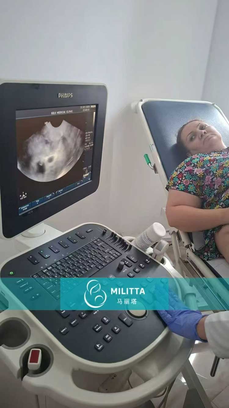 试管妈妈做产检