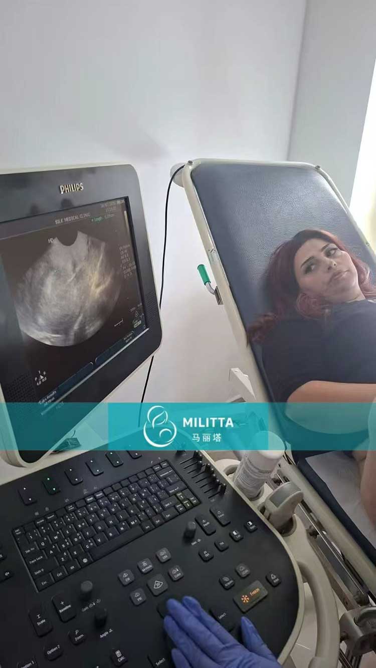 试管妈妈做产检