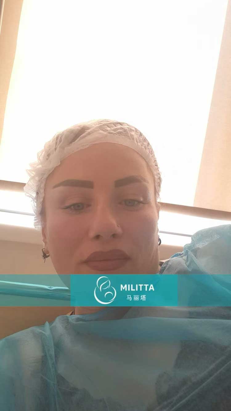 格鲁吉亚试管冻胚移植